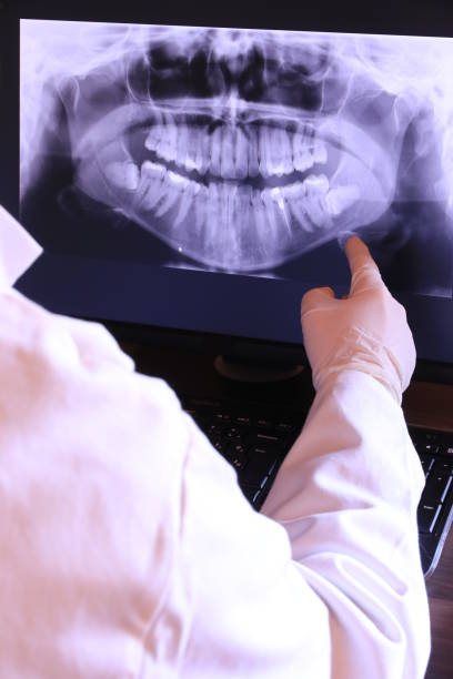 Best Emergency Tooth Extraction in Middlesex, NJ